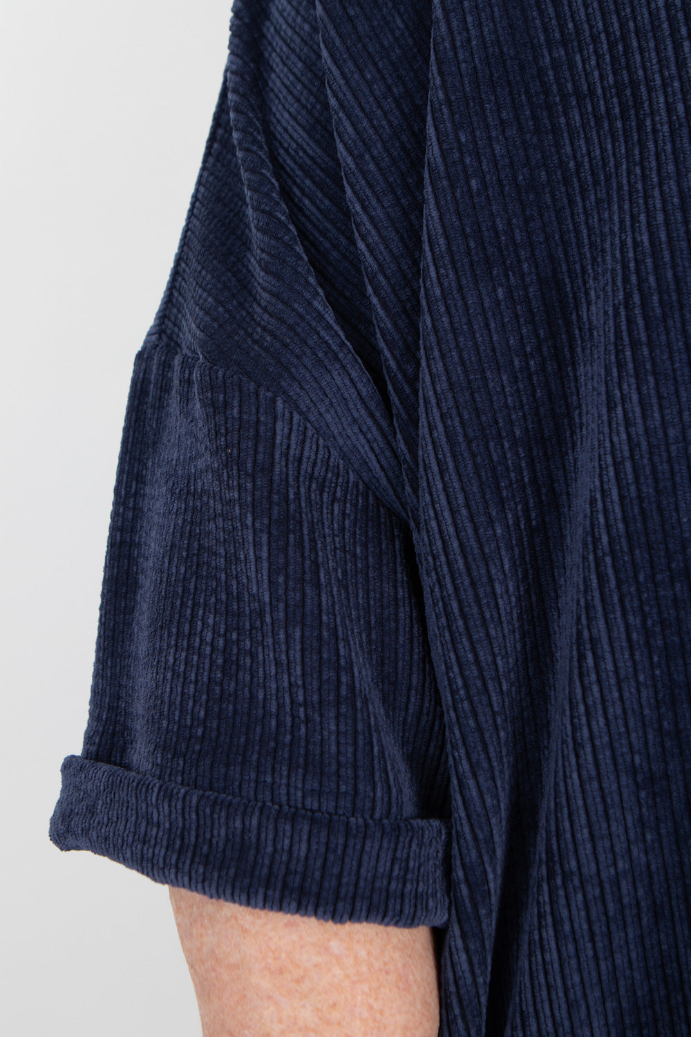 Estudio Viva Ava Tunic SAMPLE